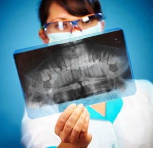 cosmetic bonding