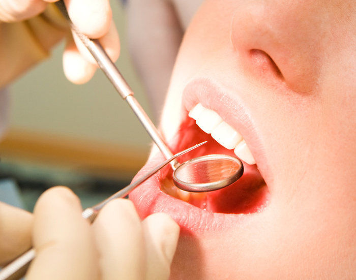 A Dentist in Ahwatukee: Understanding Dental Implants Work