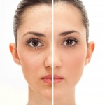 Benefits of Plastic Surgery in Dallas for a Deviated Nasal Septum
