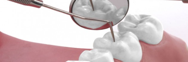 Benefits And How To Know If Dental Implants In Chicago Are Right For You