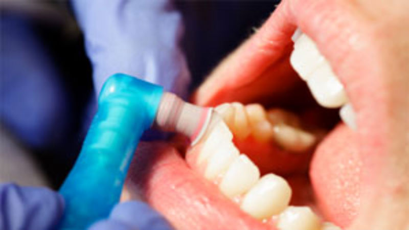 The Benefits of Dental Practices For Sale in Arizona