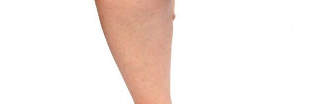 The Use of Appetite Suppressants in Medical Weight Loss in North Haven