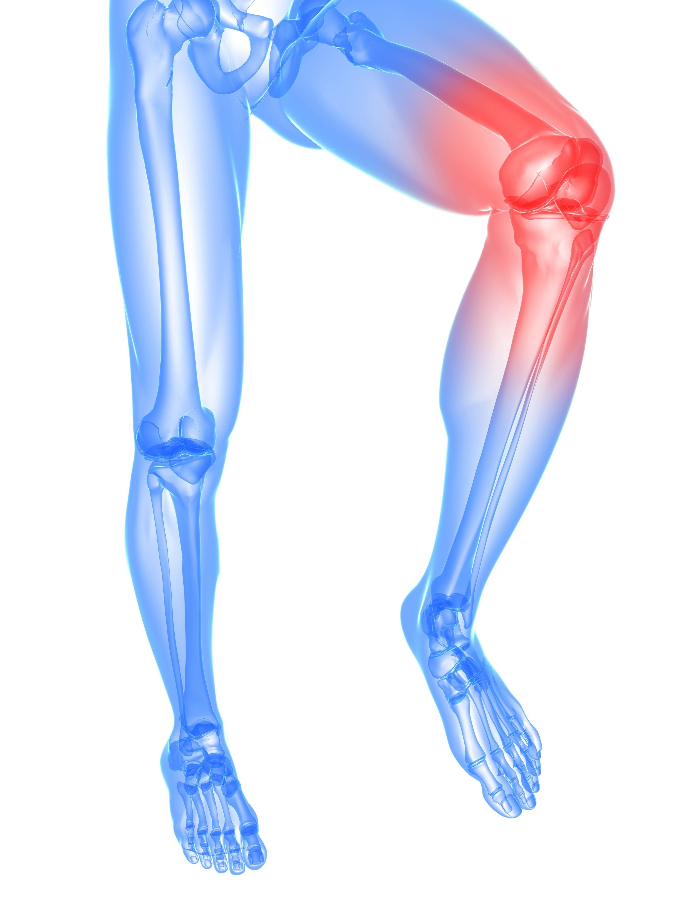 What RF Ablasion in Norman Can Do for Joint Pain