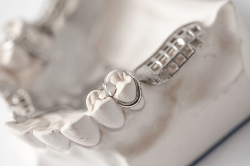 When to Have a Root Canal in Gainesville
