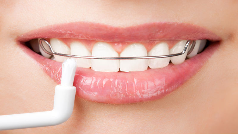 Are You a Candidate for Zoom Teeth Whitening?