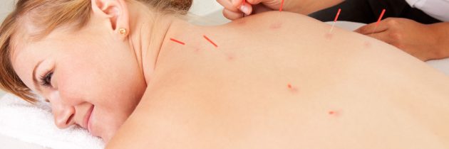 Talking About Acupuncture In Kailua Kona HI