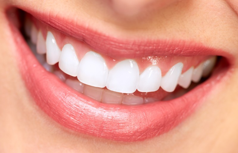 Teeth Whitening in Kendall from an Experienced Dentist