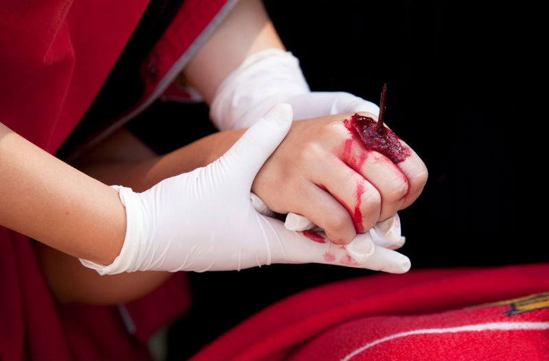 Frequently Asked Questions and Answers From Maritime Injury Lawyers in Crowley, LA.