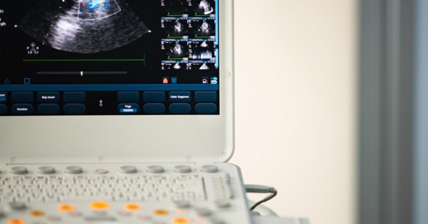 The Top Benefits You Can Reap From Buying a Used Ultrasound Machine