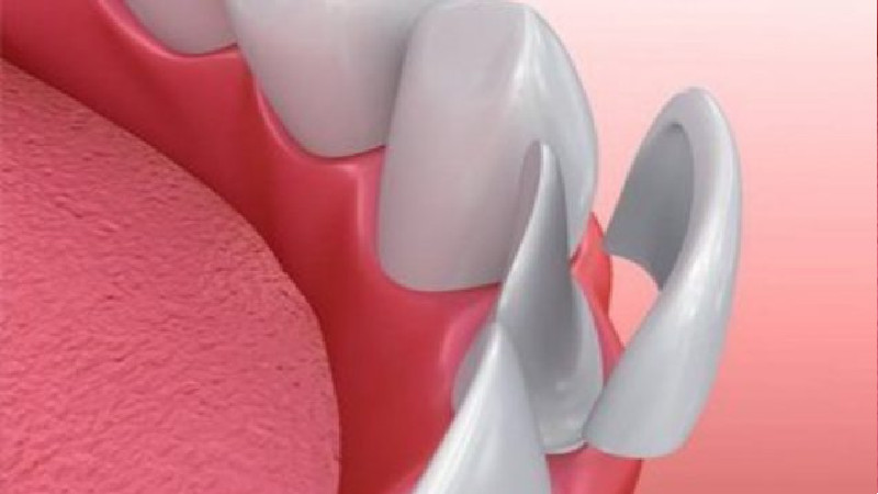 When to Call an Emergency Dentist in Valley, AL