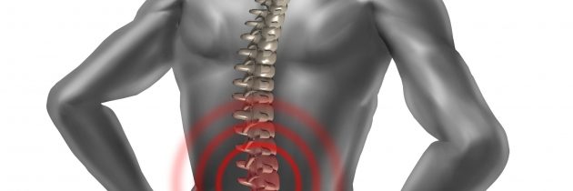 Helping You Feel Better with Spinal Canal Decompression in Dunedin