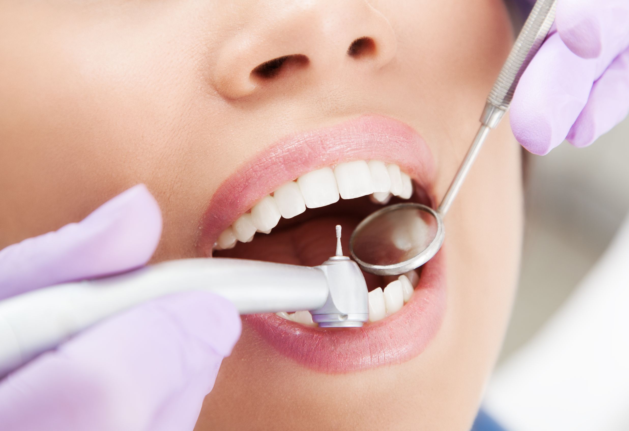 How to Find the Right Dentist in Manassas