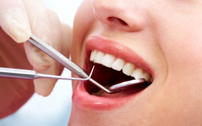 Protect Your Oral Health With Preventive Care in General Dentistry, Kennewick