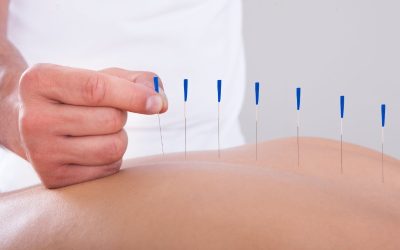 Effective Ways People Experience Relief With Acupuncture For Pain in Newark, CA