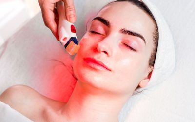 Renew and Revitalize Your Complexion With A Chemical Peel In Monroe, LA for Smoother Skin