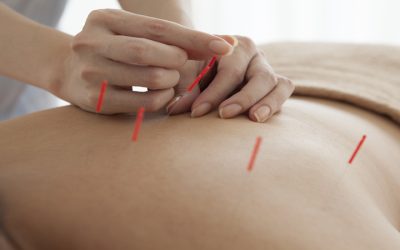 Real Relief Stories About Acupuncture For Pain Berkeley, CA: Effective Holistic Approaches